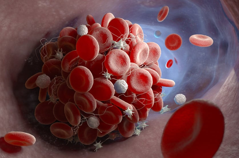 Comment faire baisser les plaquettes sanguines naturellement ?